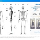전방프라자 | 대치동 필라테스 라운드숄더, 골반 전방경사 놀라운 체형변화 한달 후기