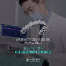 뉴큰사랑치과의원 | 강남 치아교정 치과 인비절라인+투명교정 2주 후기