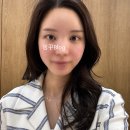 성신여대 피부과 다이브의원에서 튠페이스 60KJ 시술 후기