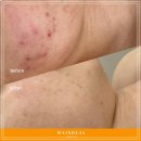 마인힐에스테틱 이미지