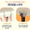 연세양치과의원 티스토리