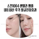 1004 | 스킨1004 센텔라 앰플 내돈내산 후기 얼굴진정효과 피부 뒤집어졌을 때