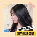 마크성형외과의원 이미지