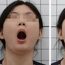 핏한의원 이미지