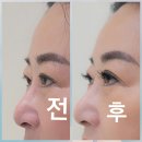 동신천 | 대구동구속눈썹 위드고 대구신천본점 솔직후기