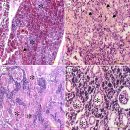 Zebrafish의 전염성 비장 및 신장괴사병(Megalocytivirus)-histology 이미지