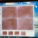 덕영빌딩 | 대구 동성로 에스테틱 추천ㅣB10 (비텐) 에스테틱 모공 시원하게 청소하고 온 후기