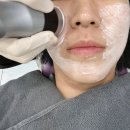 더린 | 청담 피부과 리쥬란hb 통증 피더린 PDRN관리 후기