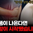 체장암 전조현상 이미지