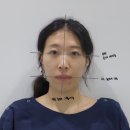 차한의원 | 안면비대칭 교정 한의원 5회차 후기 (가격, 전후사진 비교)
