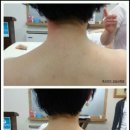 세븐일레븐 삼성동래미안 | 강남구청 등관리 후기 : 어깨 등 뭉친근육 / 등관리