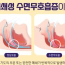 코미이비인후과의원 | 코골이 치료를 위해 수면다원화 검사를 받다