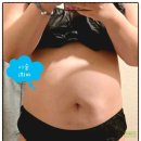 진주사 | 수원 인계동 지방분해주사 2회차 후기｜슬림해진 몸 변화, 팔뚝 효과 기대