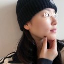 하이코코 | 홍대 하이코 홍대 코필러 미쥬코 후기 비포에프터