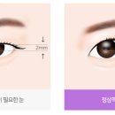 꼼꼼성형외과의원 이미지