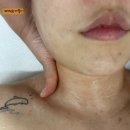 (주)씨온플러스 | 대명동 피부관리 라플러스에스떼 상체관리와 하이푸리프팅 후기