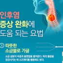 목아플때 목감기 빨리 낫는법 약 : 코로나 독감 인후통 이미지