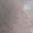 티업의원 이미지