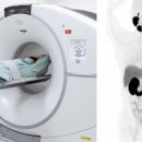 PET CT 검사 금식 시간 비용 결과 부작용 펫시티 알아야 할 정보는 이미지