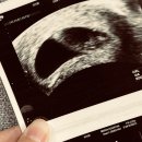 삼성생명보험(주) | 삼성생명 삼성화재 태아보험 현금 사은품 실비 20주 차에 끝낸 솔직 후기