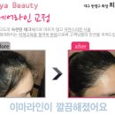 뷰티헤어라인 이미지