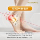 응암역 정형외과(진료과목) 아침마다 아픈 발바닥, 족저근막염의 진실
