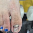 연향번영길 | [전남] 순천 광양내성발톱 발관리 각질관리 무좀관리 , 레푸스 순천연향점