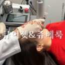 볼륨 | 청담 피부과 큐어젯 + 쥬베룩볼륨 후기 | 여드름흉터 &amp; 모공 피부교정 리얼 후기, 경과