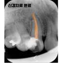 CORE 치과기공소 이미지