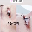 라움아이스킨