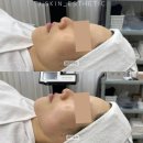 제이메디칼 | 대구 동성로 피부관리 제이스킨 수분 가득 초음파 관리 솔직후기