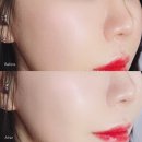 스마트스킨
