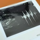 움튼산부인과의원 이미지