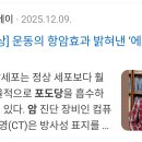 액틴이 암세포흡수 포도당 다세포(식물 생식세포)ㅋ 주파수 방향까지 하는 병신들 집단이 있음 이미지