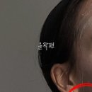 에스에스테틱 이미지