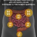 왼쪽 갈비뼈 밑 통증 아래 부위가 아픈 원인 이미지