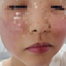 열린창약국 | 광진구 24시열린의원ㅡ휴일,연휴 야간진료 가능한곳