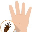 솔아로마 이미지