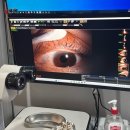 제주현대안과의원 | 강남 시력검사 라움스마일안과 정밀한 검안 시스템 및 눈 건강 체크 후기