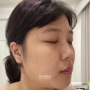 [인천 미추홀] 주안피부관리 올가드림뷰티 에스테틱 &amp; 도화피부관리 추천