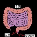 발병 위험 높은 ‘대장암’…육류 절대 먹으면 안 될까? 이미지