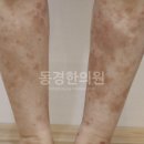 노인자