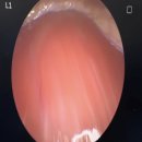 라이안성형외과의원 | 가슴성형시 신경 손상 예방