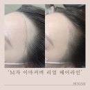 체인지헤어라인