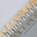 시원한치과의원 | 치아 땜빵은 이제 그만! 속 시원한 치과 찾기 대작전