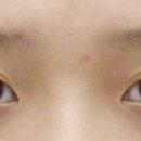 올리팅성형외과의원 이미지