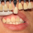 이지치과기공소 이미지