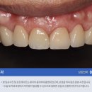 원탑 치과기공소 이미지