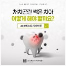 세시간치과의원 네이버블로그