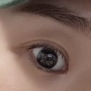 멍메이드 | 🌻강남 메이드영 성형외과 자연유착 쌍수 + 앞트임 수술 후기 (내돈내수)🌻